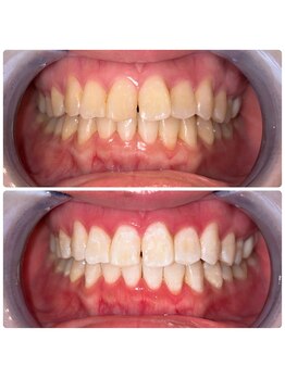 コナホワイトニング 神保町/セルフホワイトニング神保町