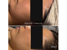 リセル 月島(ReCeLL)の雰囲気（【小顔リフト】高周波・RF・高濃度ヒト幹導入・IPL・ハンド小顔）