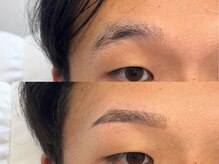 メンズアイブロウサロンバイクロト 天神大名(MEN’S EYEBROW SALON by KUROT)/B&A