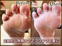 ビューティースパ(Beauty-Spa)の雰囲気（お悩みの硬く厚い足裏全体・ガサガサ・ヒビ割れかかとの角質除去）