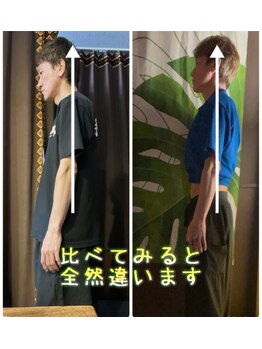 ワンランク上の整体院 名古屋栄店/整体ビフォアーアフター　栄整体