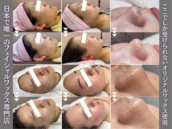 ホワイトワックス 名古屋金山店(WHITE WAX)/フェイシャルワックス専門店♪