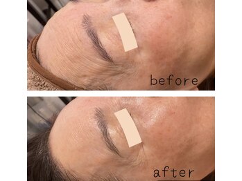 エヌ セレクション(N_selection)/ハリツヤふっくら整う!!