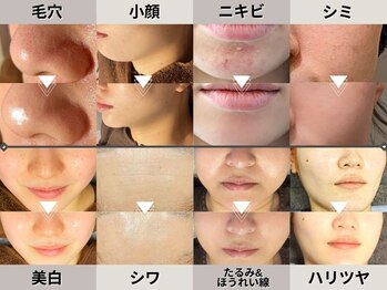 ルディラ医療提携エステ 大宮店 毛穴/小顔/ニキビ・シミ【2/1 NEW OPEN（予定）】