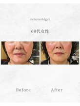 ねこのひげ/お客さんの変化