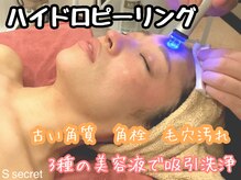 エス シークレット 金町店(S secret)/ハイドロピーリング　毛穴汚れ