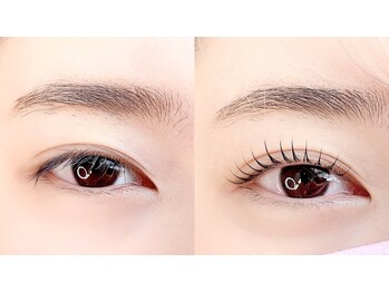 ありる/ビフォーアフター