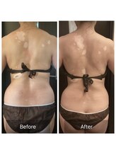 ウノジェンネ UNO DJENNE/50代★頑固な肩こりも一緒に改善