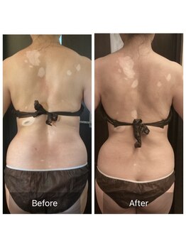 ウノジェンネ UNO DJENNE/50代★頑固な肩こりも一緒に改善