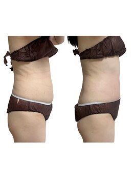 タルボ(TALBO)/お腹周りを引き締めたい方