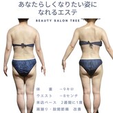 ビューティサロンツリー(TREE)