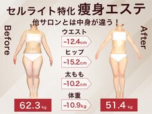 ラ パルレ 新宿本店の雰囲気（全身ボディケア/サイズダウン/体型ケア/温熱ケア/セル脂肪）