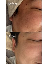 ニコ(nico)/肌が変われば、人生が変わる。