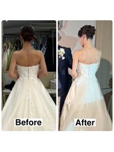 ライズ/お客様のビフォーアフター