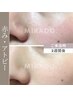 【ハーブピーリング/肌荒れ/赤み】ソフト1Day/90分 カウンセリング¥0