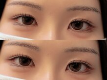 ユーロ(EURO)/ラッシュリフト／まつ毛パーマ