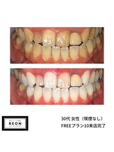 レオン 磐田(REON)/◇ お客様 before＆after ◇
