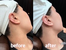 バーバーショップ 難波店(BARBER SHOP)/before/after