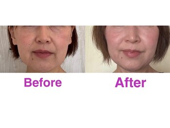 ハッピービューティーサロン じゆう(Happy Beauty Salon J∞YOU)/魔法のミラクルリターンフェイス