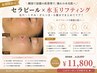 【韓国肌管理★】セラピール×水玉リフティング｜毛穴・くすみ・小顔 ￥11,800
