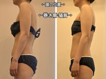 プリンセス ボディの写真/【口コミ5.0★】首・肩こりを姿勢から整える！体のくせを見直して全身巡がよく美しいボディラインへ◎