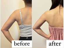 グラナーダ(granada)/小顔造形マシン【ブライダル】