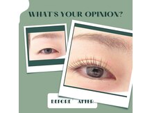 アイシック 勝どき(eyechic)