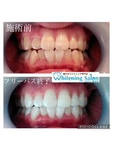 シフォン 豊田店/3週間フリーパス終了のお客様