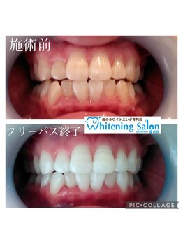 シフォン 豊田店/3週間フリーパス終了のお客様