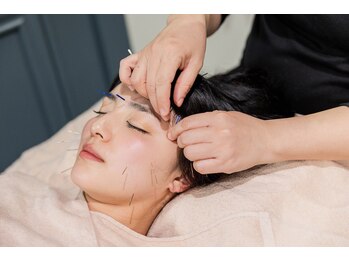 サリエ(S'allier)/美容鍼