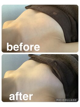 ギンザアール(GINZA R.)/バストアップ♪