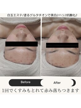 一呼休/フェイシャルエステ