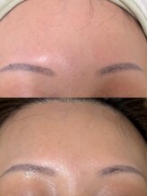 ミレマユメイク(mire)/大人の肌質改善ララピール