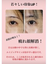 真美(Sinbi)/施術5回変化レベルも上げ上げ!