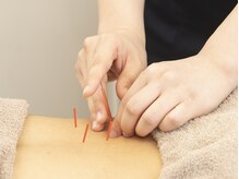 ニワトコ 与野駅前院(niwatoco)/鍼施術