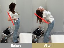 せなかのはね 難波心斎橋店/20代 猫背 腰痛 反り腰