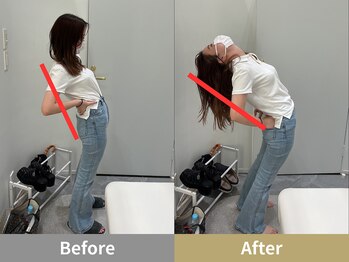 せなかのはね 難波心斎橋店/20代 猫背 腰痛 反り腰