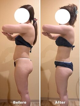 ソラウミ(SORAUMI)の写真/短期集中ダイエットで上半身と下半身をケア！理想のスタイルを目指すサロン★