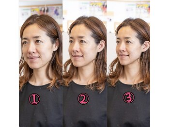 北梅田美容鍼灸院/【大阪/梅田】ビフォーアフター