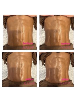 ビボーン ボディ(美bone body)/ハイパーナイフカット出し