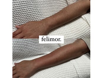 フェリモール(Felimor.)/シュガーリングbefore／after
