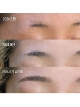 ユマニ バイ ヒート(Humani by HEAT)/ハリウッドブロウリフト