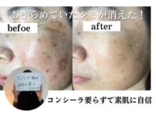 パールホワイトニングサロン 大和店の雰囲気（大きいシミから小さいシミ改善/大和シミケア/ホワイトニング）