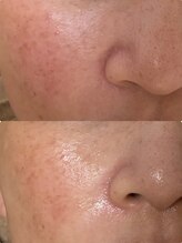 ミレマユメイク(mire)/くすみ改善/明るい素肌づくり