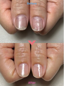 ワイ(Y)/自爪育成