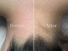 ライズ 札幌店(RISE)の雰囲気（お肌に優しいシュガーリング脱毛で毛穴レスなお肌に！）