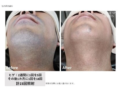 メンズスキンラボ(MEN'S SKIN LABO)の写真