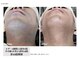 メンズスキンラボ(MEN'S SKIN LABO)の写真