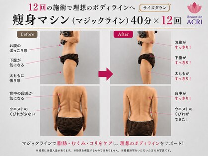 ボーテドアクリ 元町店(Beaute de ACRI)の写真