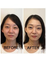 アマルジーナ(AmalZwina)/【パーソナルカラー診断】